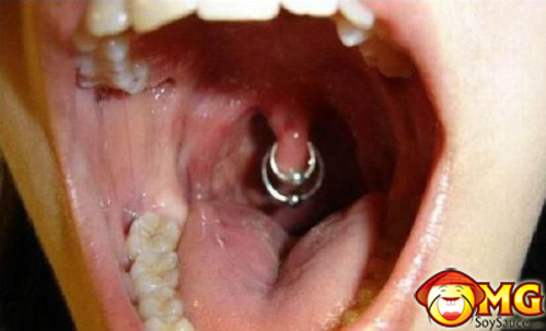 tonsil-piercing